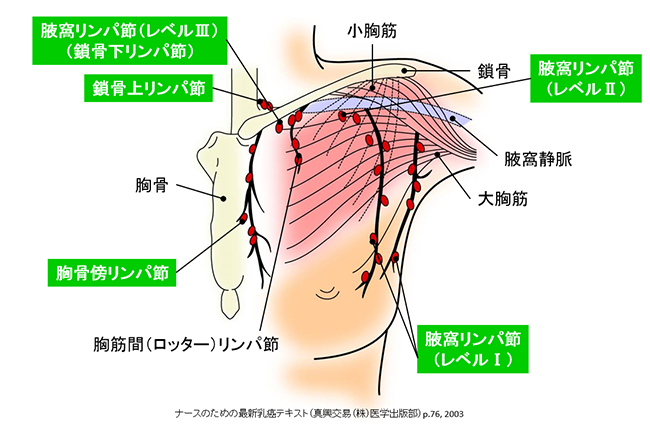 乳腺所属リンパ節の区分